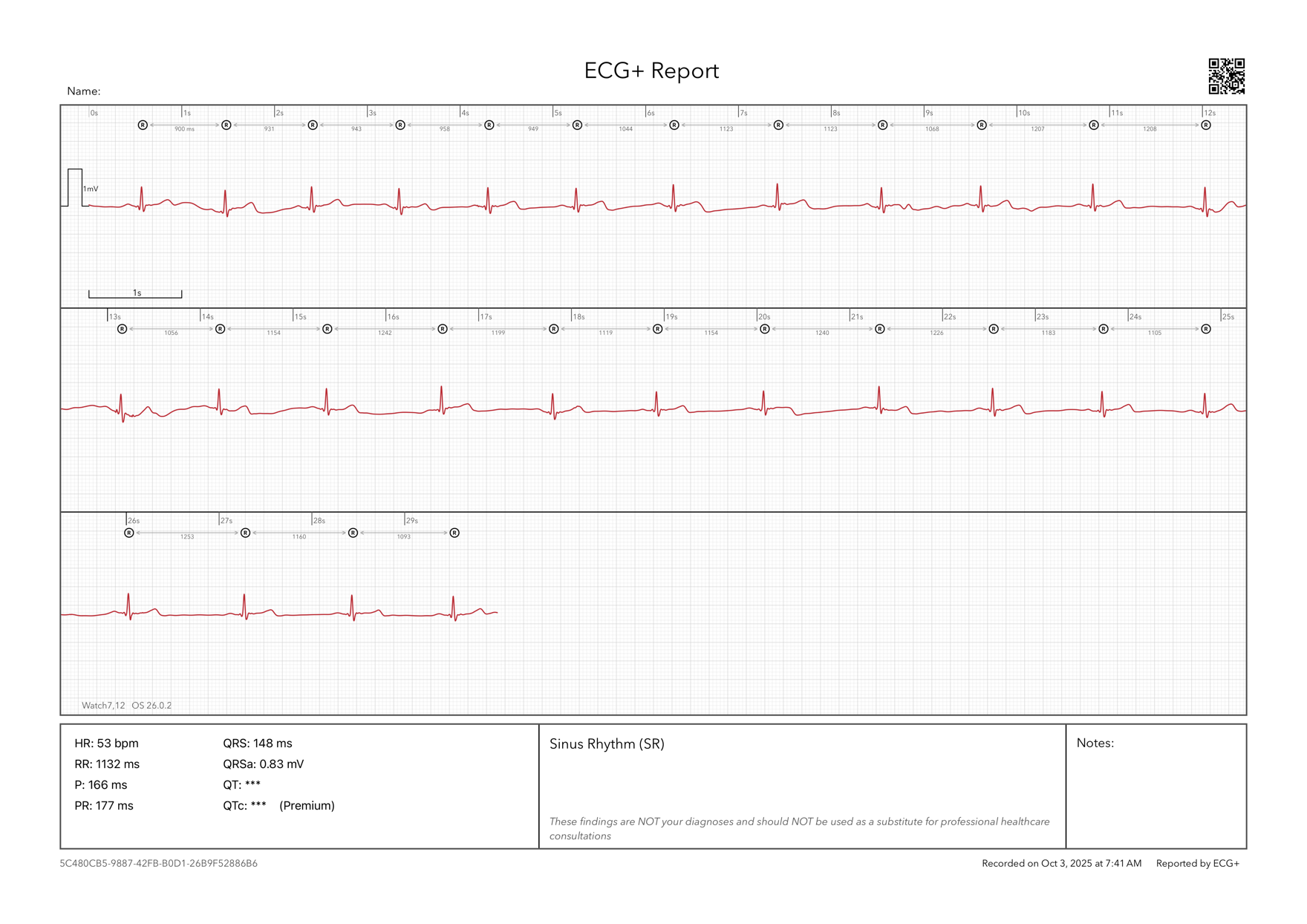 ECG strip from an Apple Watch Ultra 3, interpreted by the ECG+ app, showing a heart rate of 53 bpm and RR interval of 1132 ms over a 29-second recording